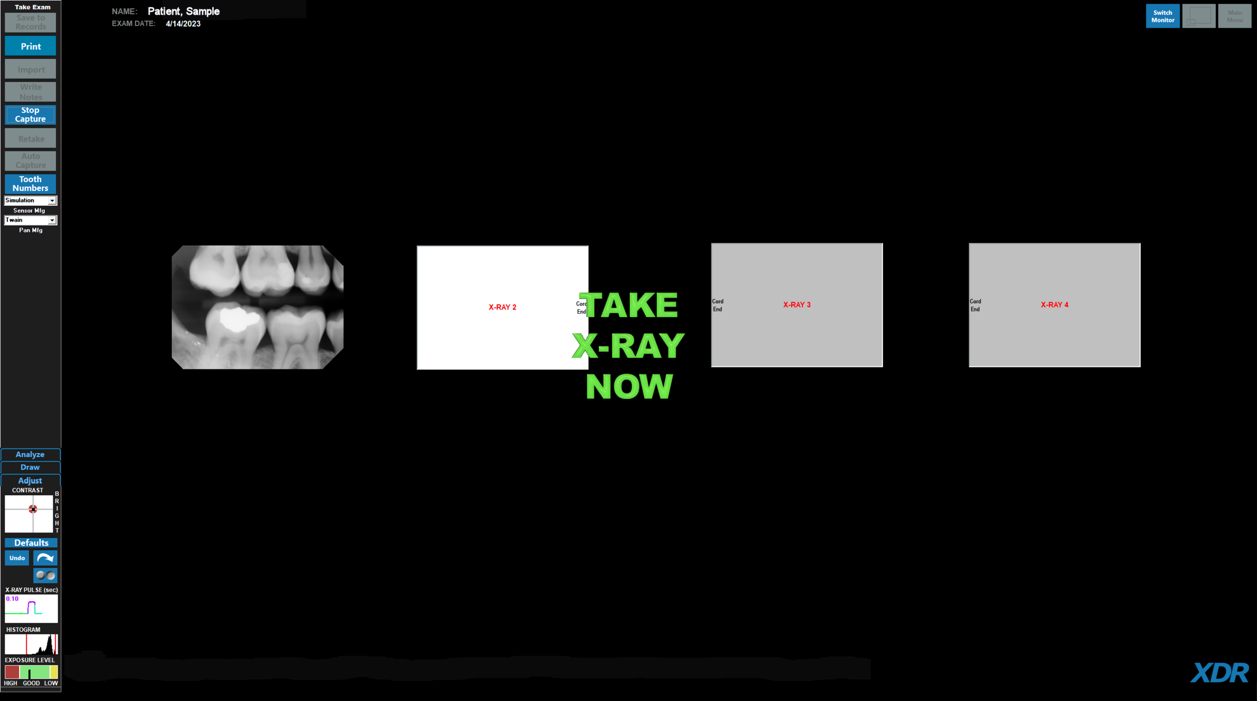 XDR - X-ray Screen Sample
