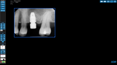 XDR imaging sample patient image